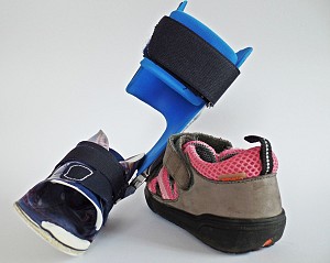 Orthese-schiene und Schuh